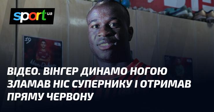 ВІДЕО. Гравець Динамо Вінер завдав супернику травму носа, що призвело до прямої червоної картки.